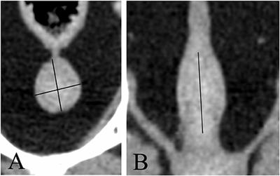 Intra- and Inter-observer Variability of Computed Tomographic Measurements of the Prostate Gland in Neutered Dogs